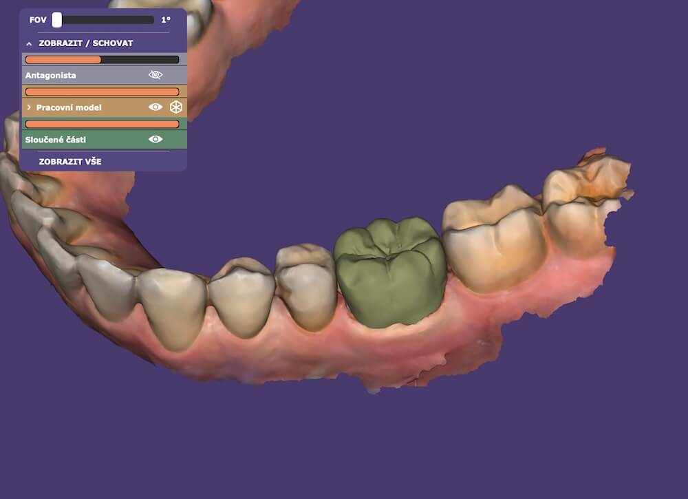 CAD náhledy pro zubní lékaře