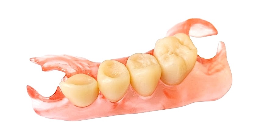 Mezerník Acetal a&nbsp;mezerník 3D&nbsp;tisk: nové možnosti snímatelných náhrad