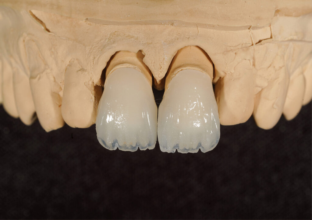 Dentální estetika individuální práce zubního technika